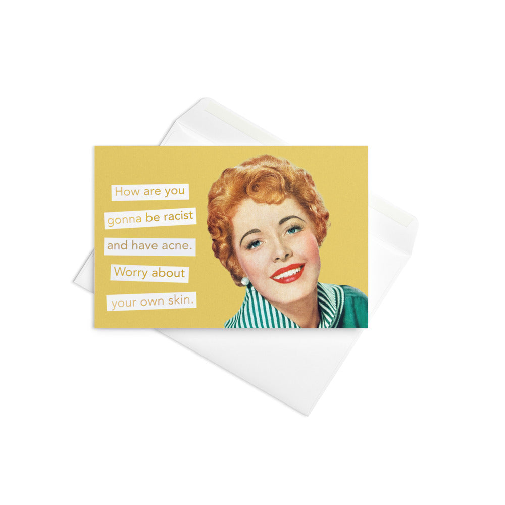 How Are You Gonna Be Racist And Have Acne. Worry About Your Own Skin - Greeting Card