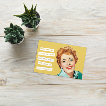 How Are You Gonna Be Racist And Have Acne. Worry About Your Own Skin - Greeting Card