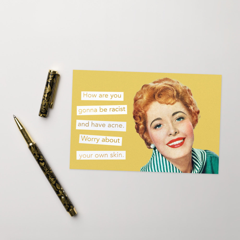 How Are You Gonna Be Racist And Have Acne. Worry About Your Own Skin - Greeting Card